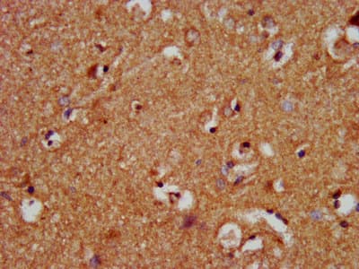 NOD8 / NLRP10 Antibody