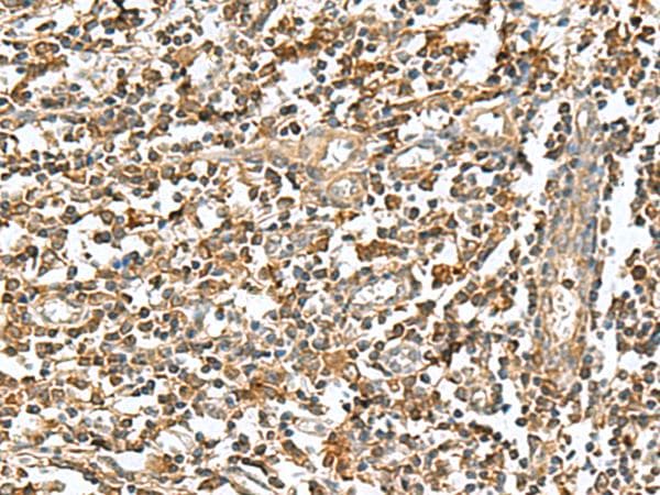 Polyclonal Rabbit anti-Human RAB23 Antibody (IHC)