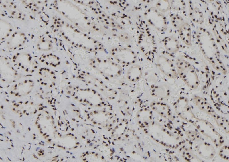 HDLBP / Vigilin Antibody