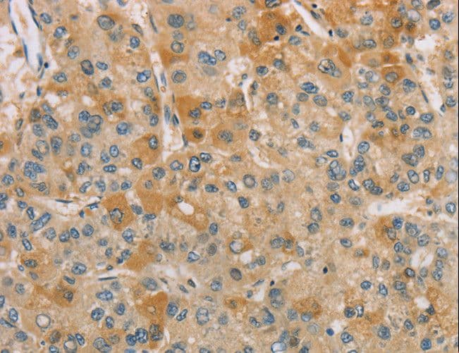 CENPF / CENP-F Antibody