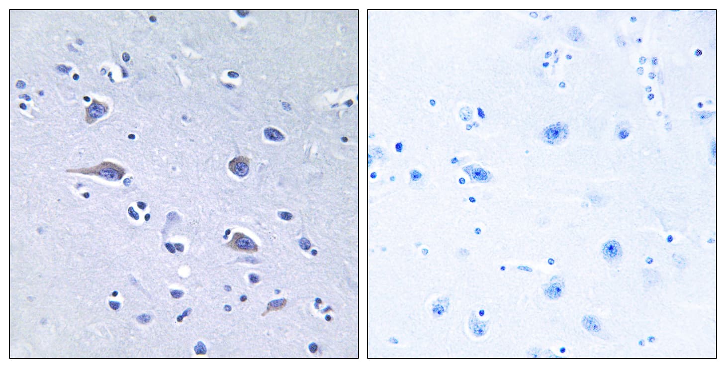 Polyclonal Rabbit anti-Human RPS6KB1 / P70S6K / S6K Antibody (phospho-Thr229, IHC, WB)