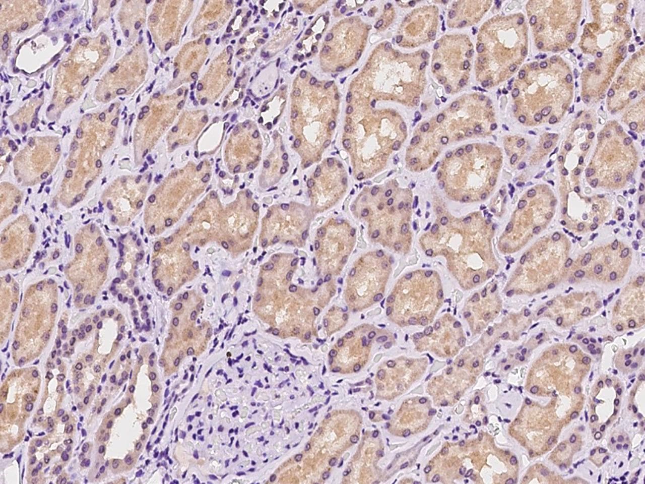 SLC13A1 Antibody