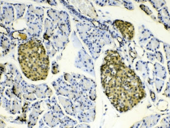 Polyclonal Rabbit anti-Human HSPB8 / H11 / HSP22 Antibody (IHC, WB)