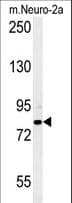 Polyclonal Rabbit anti-Human CPEB4 Antibody (aa109-137, IHC, WB)