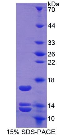 Human UCN2 / SRP Protein (Recombinant His)