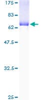 Human IDH3A Protein (Recombinant GST)