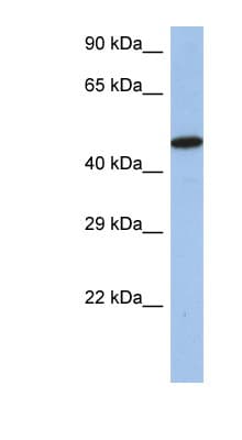 IRF5 Antibody (aa395-444)
