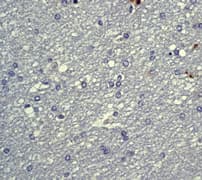 PRKCA / PKC-Alpha Antibody (phospho-Thr638, clone E195)