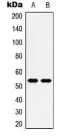 HTR2B / 5-HT2B Receptor Antibody (N-Terminus)