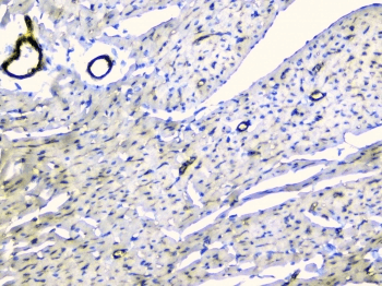 TEK / TIE2 Antibody