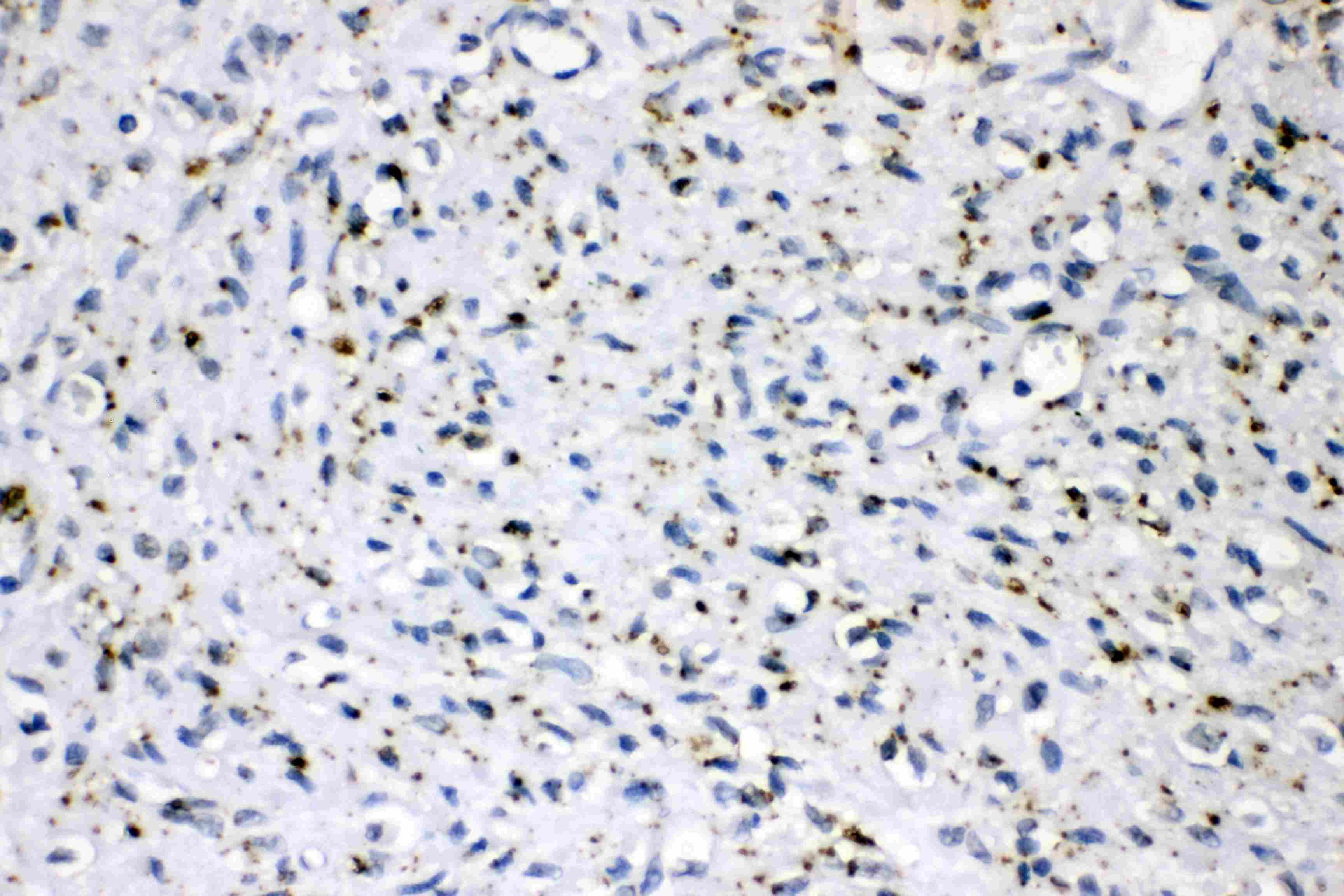 PLIN2 / ADFP / Adipophilin Antibody