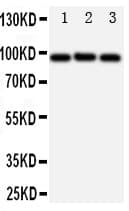 Polyclonal Rabbit anti-Human ABCB6 Antibody (aa818-842, IHC, WB)