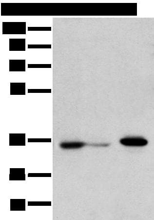 DHRSX Antibody
