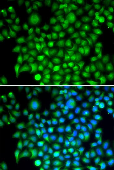 CFI / Complement Factor I Antibody