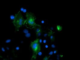 PECAM-1 / CD31 Antibody (clone OTI1G6)