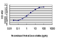 Monoclonal Mouse anti-Human ZIC4 Antibody (clone 3D5, IF, WB)