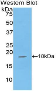 GPX4 / MCSP Antibody (aa74-197)