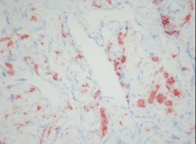 CD163 Antibody (clone 5C6-FAT)