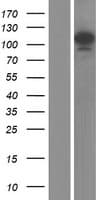 SART1 Protein (Over-Expression Lysate Myc-DDK (Flag))