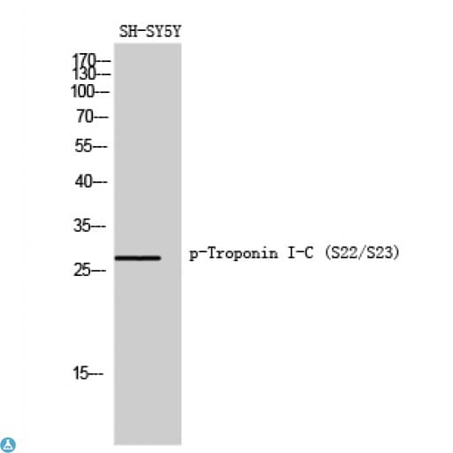 TNNI3 / Cardiac Troponin I Antibody
