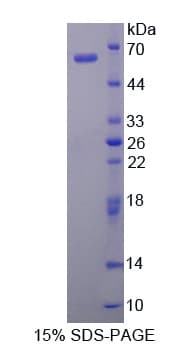 Human Cytokine IK Protein (Recombinant His-GST-S)