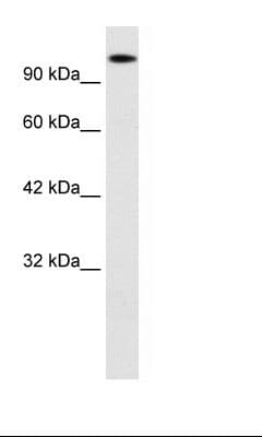 HIPK2 Antibody (aa384-433)