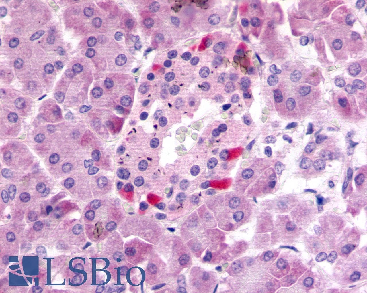 PathPlus™ Polyclonal Rabbit anti-Human FKSG80 / GPR81 Antibody (Extracellular Domain, IHC)