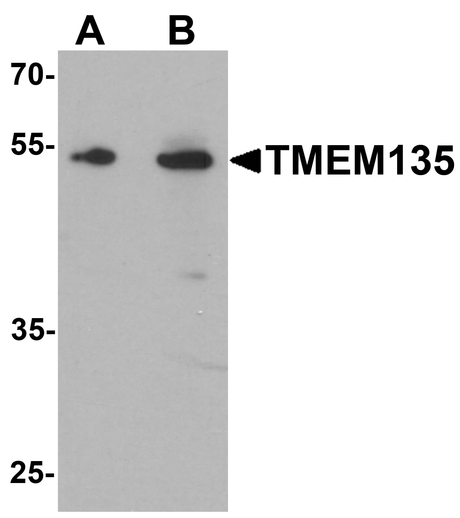 IHC-plus™ Polyclonal Rabbit anti-Human TMEM135 Antibody (IHC, IF, WB)