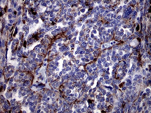 Monoclonal Mouse anti-Human CTSL / Cathepsin L Antibody (clone OTI2H2, IHC, WB)