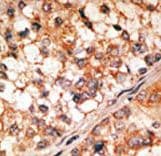 BCL2L11 / BIM Antibody (aa130-165)