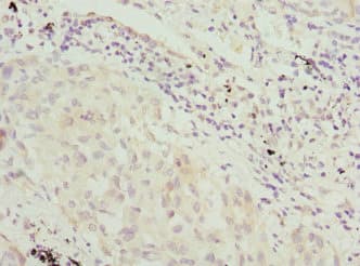Polyclonal Rabbit anti-Human VRK1 Antibody (IHC, WB)