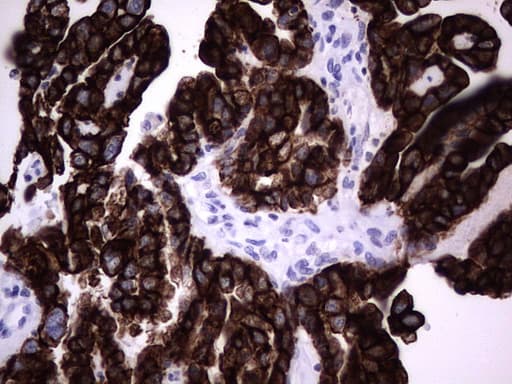 KRT19 / CK19 / Cytokeratin 19 Antibody (aa240-390, clone OTI3D10)