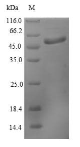 Human CHCHD3 Protein (Recombinant GST, N-terminus)