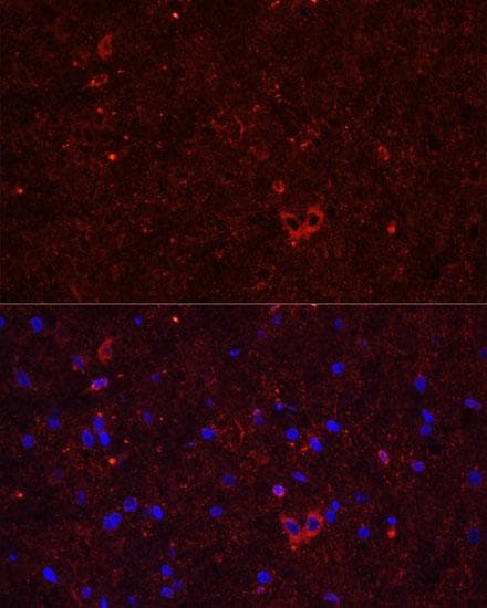 GRIA2 / GLUR2 Antibody