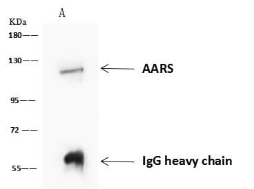 AARS Antibody