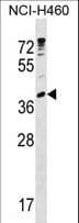 UBE2U Antibody (aa2-30)