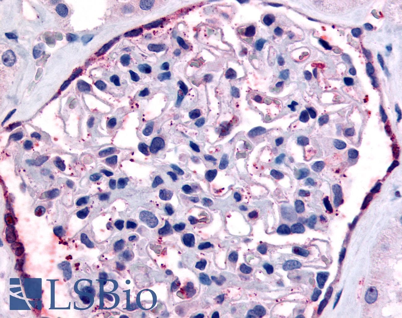IHC-plus™ Polyclonal Rabbit anti-Human F2RL1 / PAR2 Antibody (Extracellular Domain, IHC)