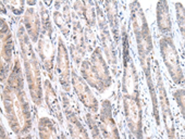 CALB2 / Calretinin Antibody