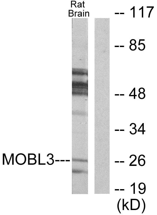 MOB4 / PHOCN Antibody