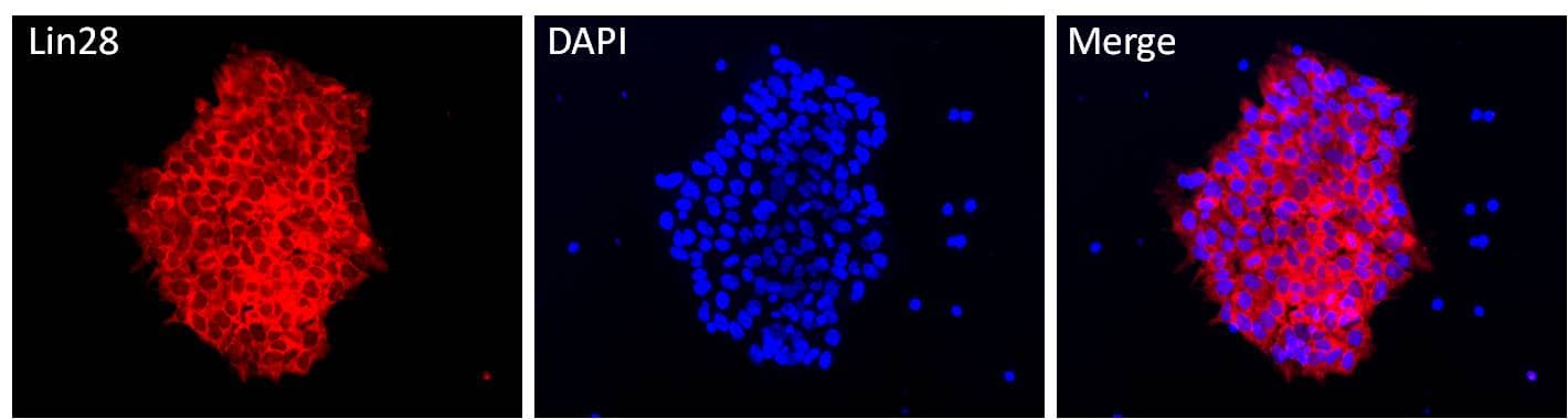 IHC-plus™ Polyclonal Rabbit anti-Human LIN28A / LIN28 Antibody (IHC, IF, WB)