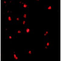 Polyclonal Rabbit anti-Human c-CBL Antibody (IF, WB)