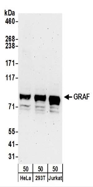 Polyclonal Rabbit anti-Human ARHGAP26 / GRAF Antibody (aa611-661, WB)