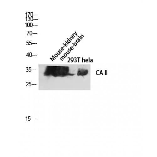 CA2 / Carbonic Anhydrase II Antibody (C-terminal)