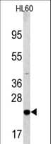 Polyclonal Rabbit anti-Human BAD Antibody (aa53-81, IHC, WB)