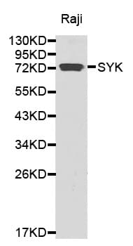 Polyclonal Rabbit anti-Human SYK Antibody (IHC, WB)