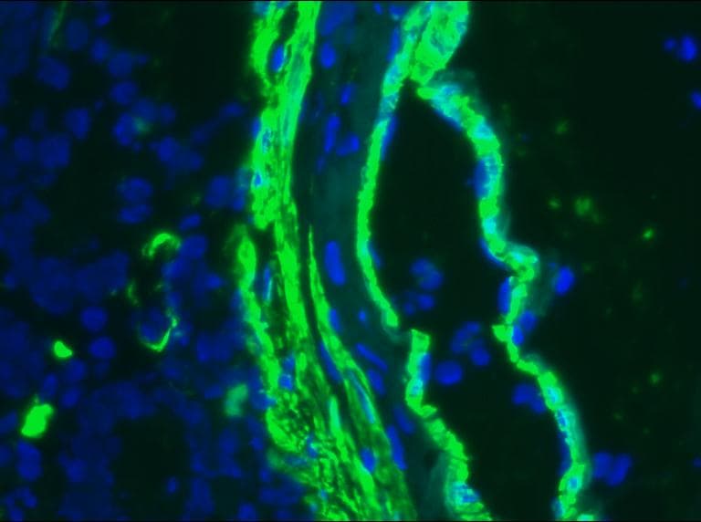 ACTA2 / Smooth Muscle Actin Antibody (clone IA4)