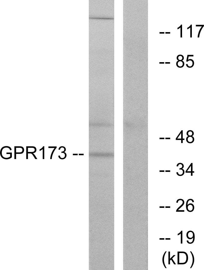 GPR173 / SREB3 Antibody
