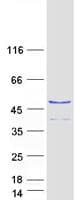 Human RNF113A Protein (Recombinant Myc-DDK (Flag))