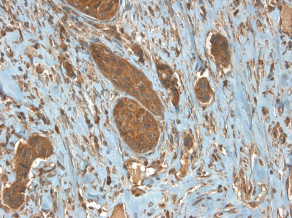 Monoclonal Mouse-Balb/c anti-Human ERBB2 / HER2 Antibody (clone 9G6, IHC, IF, WB)