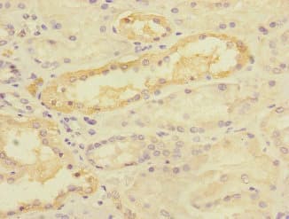 Polyclonal Rabbit anti-Human TIMM50 Antibody (IHC, WB)
